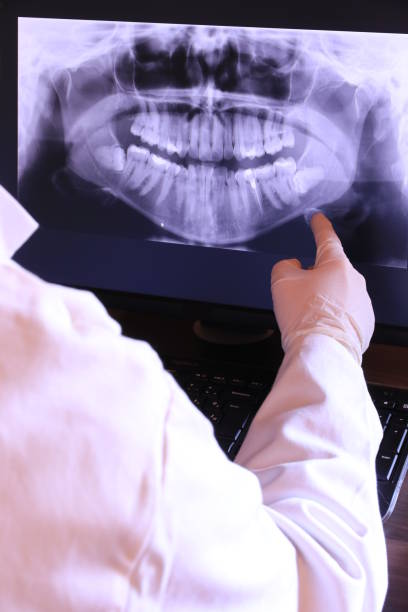 Best Knocked-Out Tooth (Avulsed Tooth) Treatment in College Station, TX